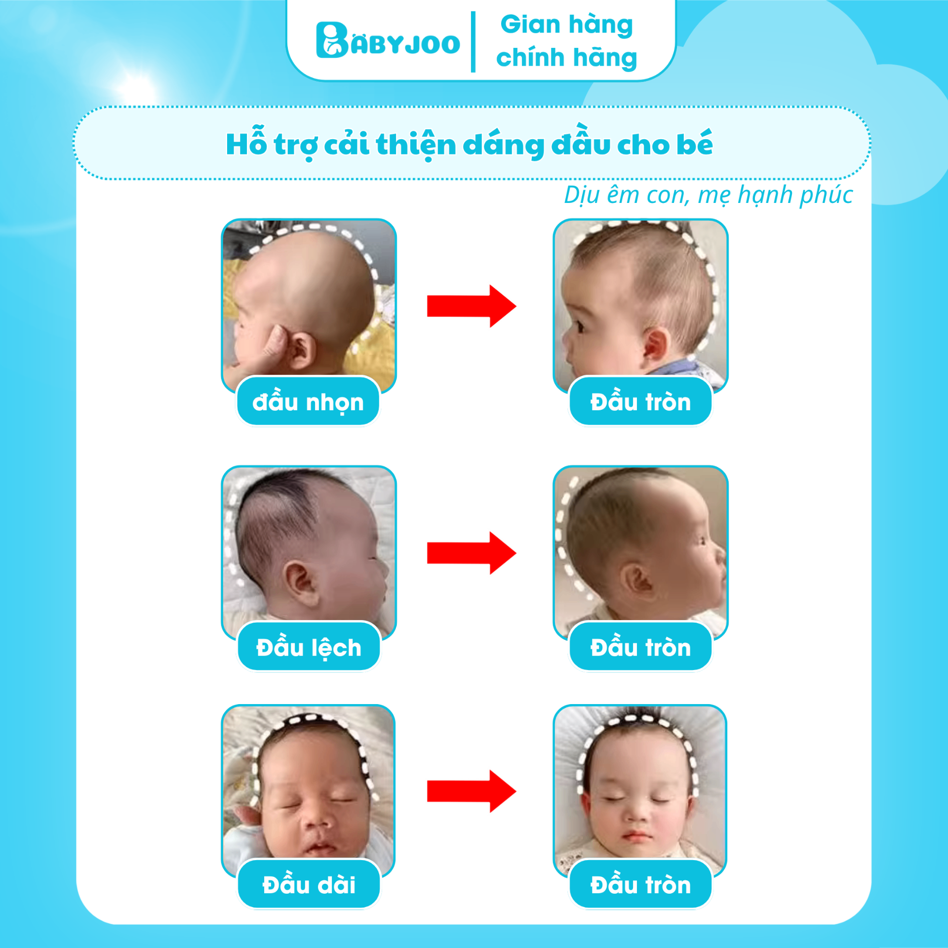 Gối chống bẹp đầu BABYJOO chính hãng — ảnh 7